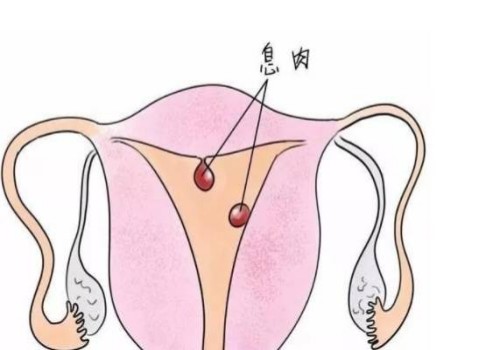天津代怀代生公司：﻿新生儿黄疸不用慌告诉你一些家用小妙招