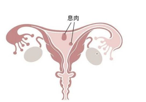 天津代生男孩：﻿内膜0.8cm持续无月经？了解着床怀孕几率的重要性